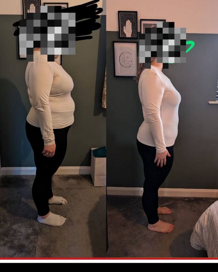 JDD client before and after photos