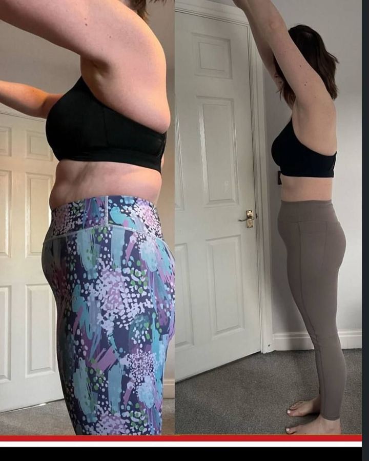 JDD client before and after photos