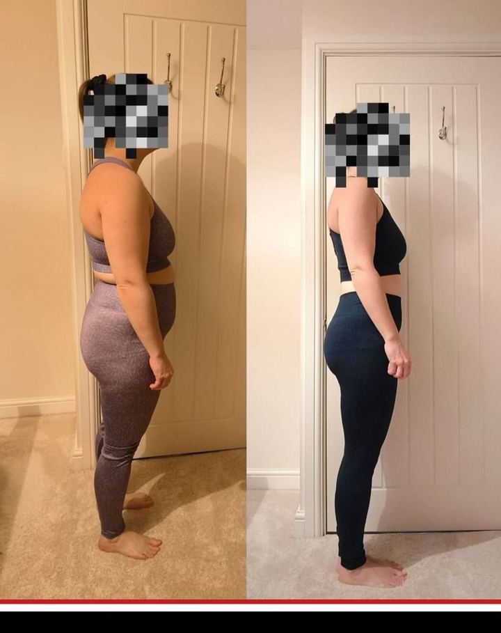 JDD client before and after photos