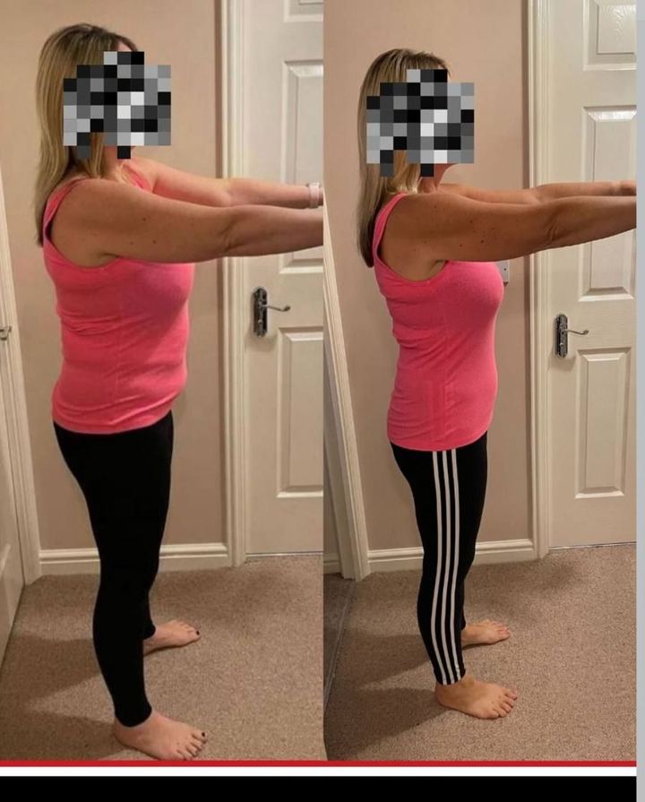 JDD client before and after photos