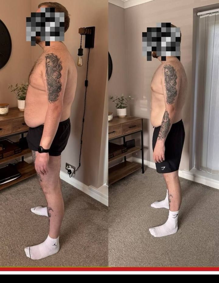 JDD client before and after photos