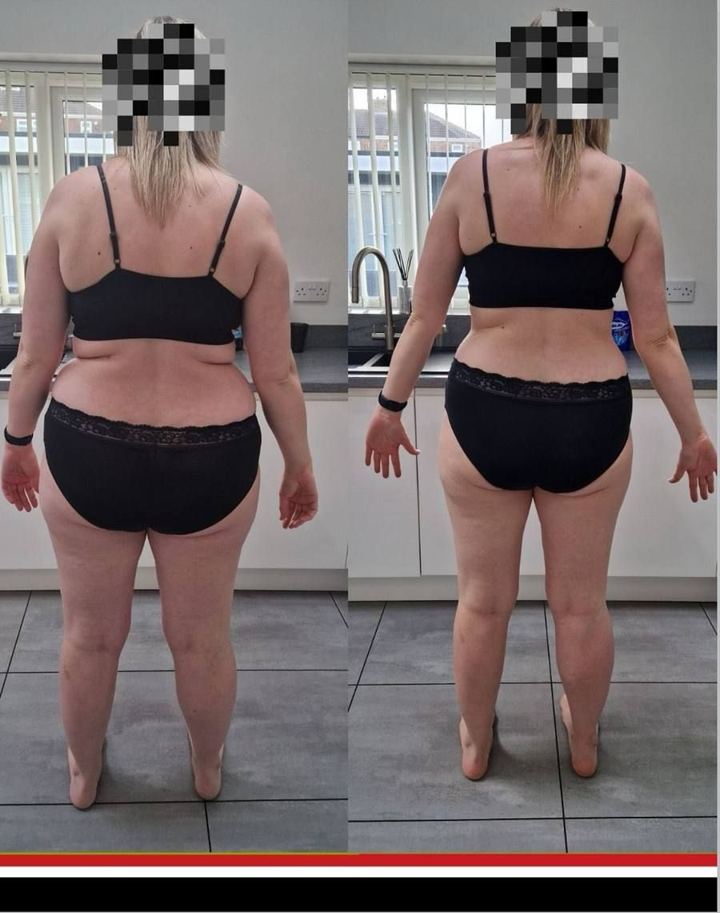 JDD client before and after photos